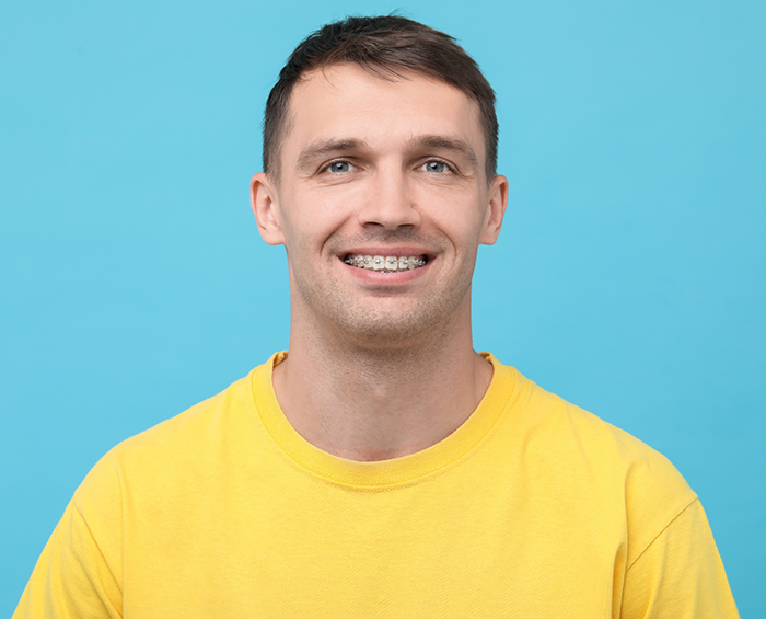 Adult man smiling with braces
