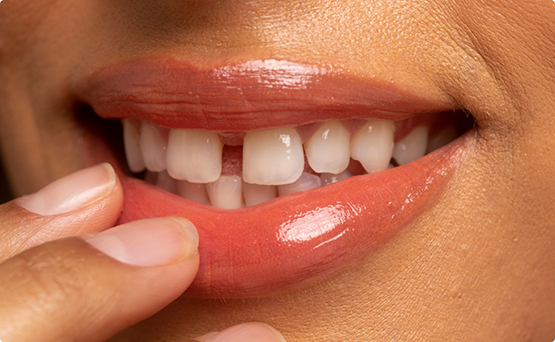 Mouth with a gap between the two front teeth