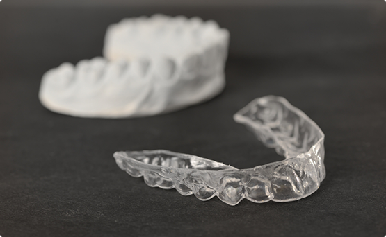 Invisalign aligner next to a mold of a patient's teeth