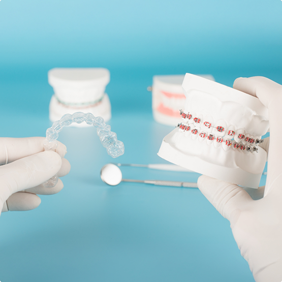 Orthodontist holding Invisalign and a model of the teeth with braces