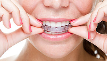 Invisalign Vs Braces: Which One Should You Choose? - Center for  OrthodonticsCenter for Orthodontics